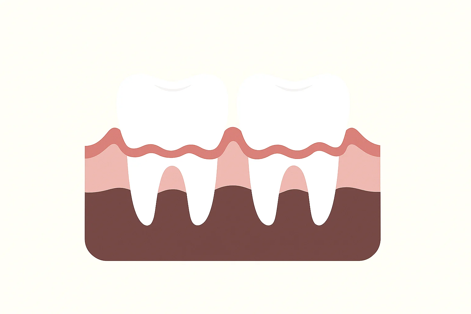gum disease therapy in Sarasota, FL at Modern Smile Design