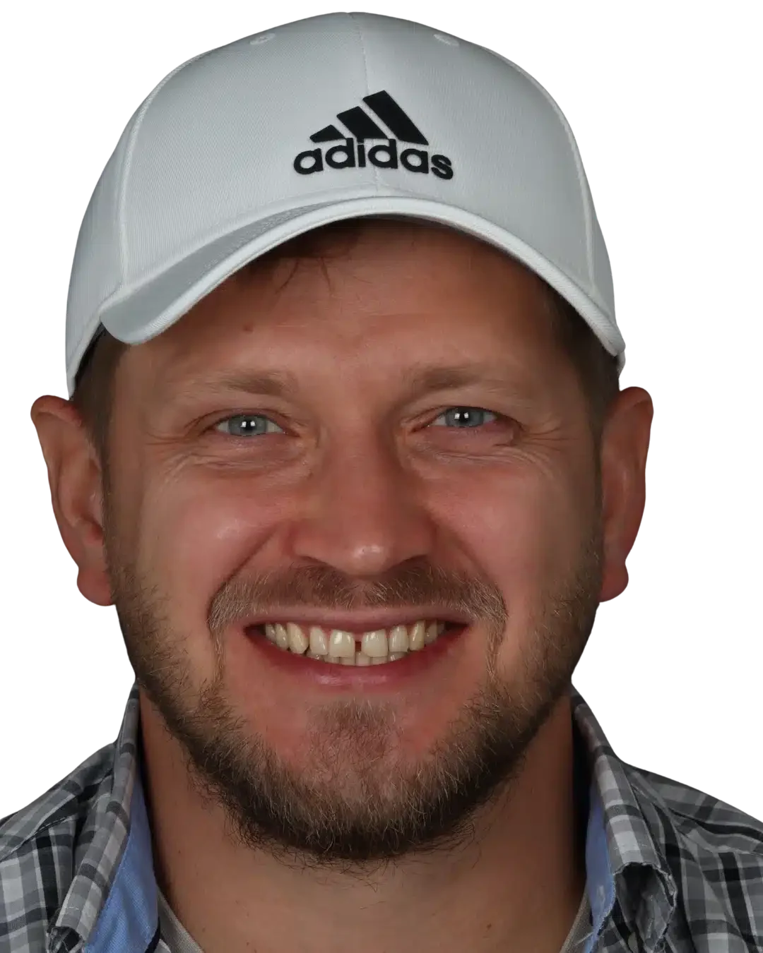 Patient smiling before invisalign treatment treating gaps at Modern Smile Design in Sarasota, FL