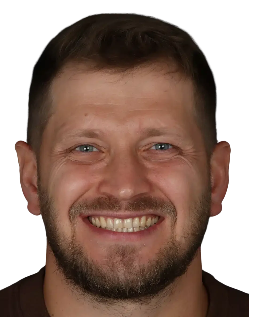 Patient smiling after invisalign treatment treating gaps at Modern Smile Design in Sarasota, FL