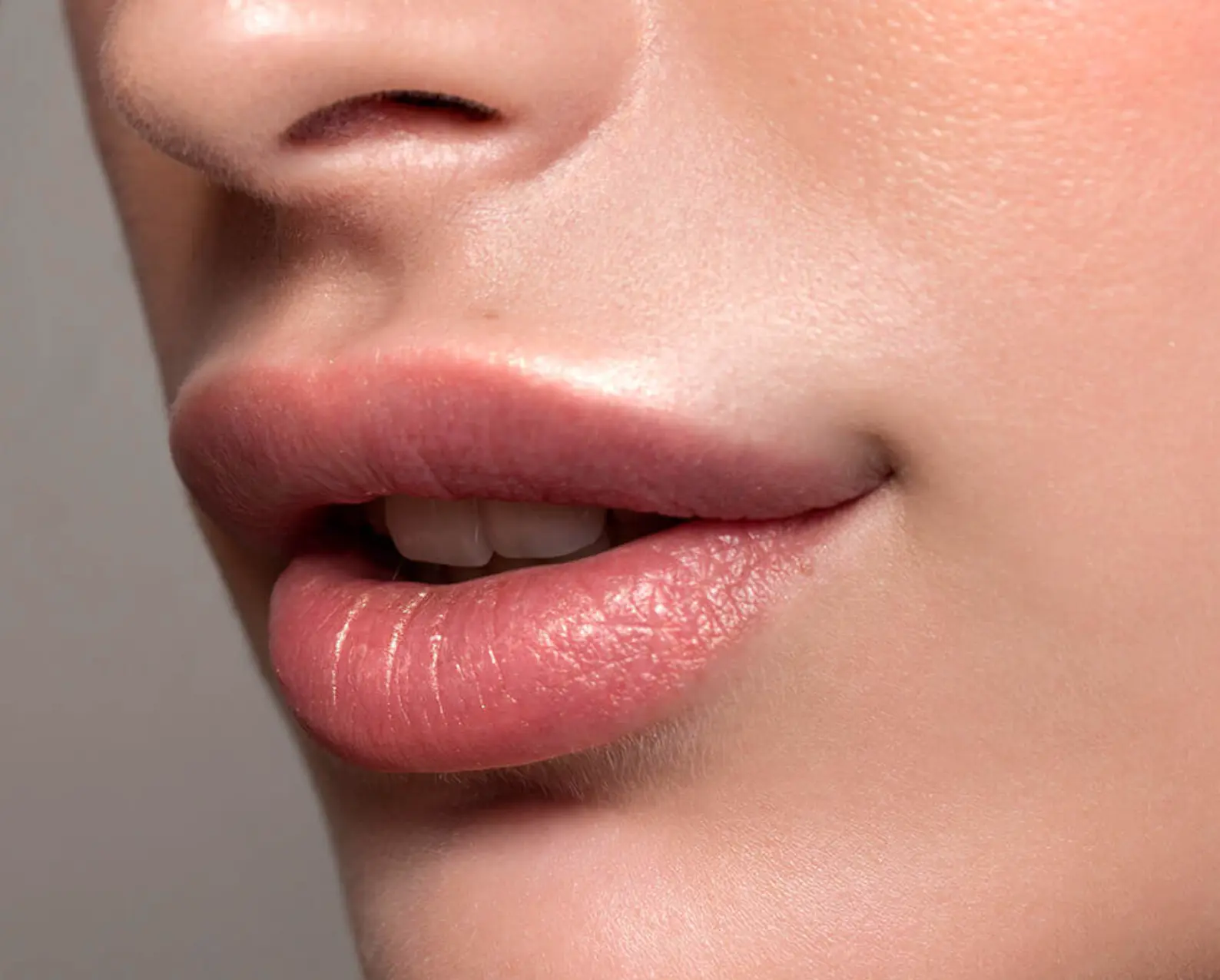 Natural, defined lips representing the subtle result of Fotona LipLase enhancement