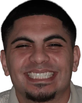 Happy patient smiling after Invisalign Treatment in Sarasota, FL