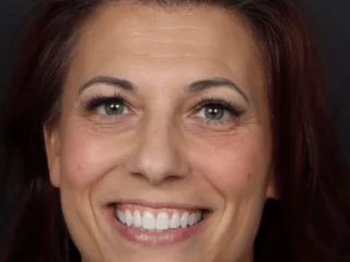 smiling patient at modern smile design in sarasota, FL smiling patient at modern smile design in sarasota, FL