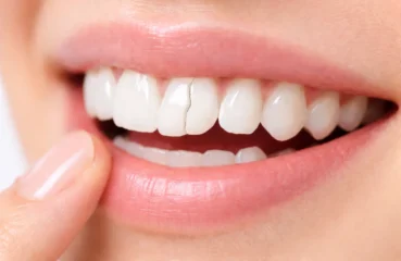 crackedtoothcard