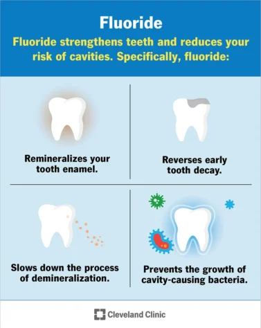 Diagram showing how fluoride strengthens enamel and reduces tooth decay